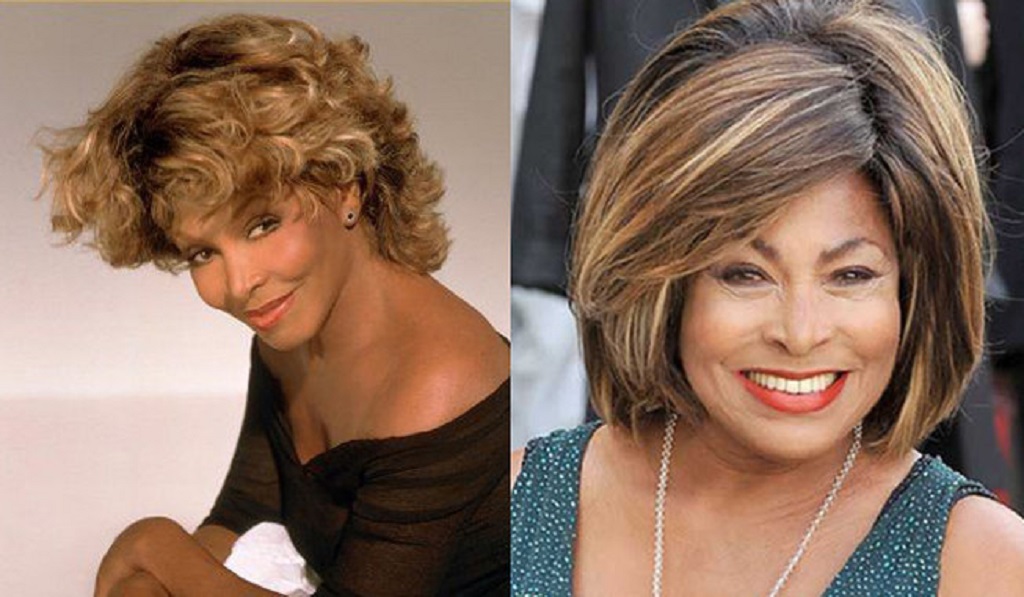 Tina Turner Botox