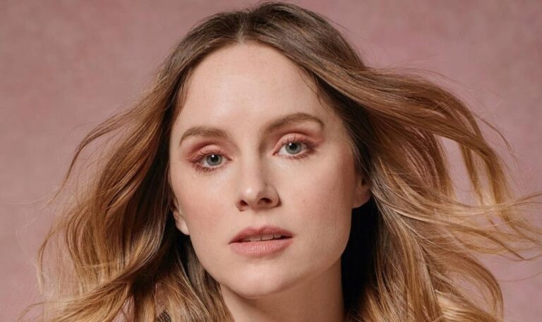 Sophie Rundle Plastic Surgery: Has She Done Jaw Surgery And Botox